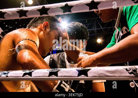 Bangkok, Thailand - May 1, 2026 : Exhausted Muay Thai fighter resting in ring corner while trainers pour water on his head to cool down between rounds Stock Photo