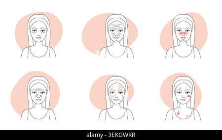Minimal female face collection showing wrinkles, rosacea, freckles, pigmentation, acne and rash symptoms in clean outline style, isolated on white background vector illustration Stock Vector
