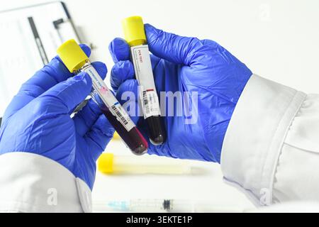 Close-up of gloved hands holding blood tubes labeled PCR and antibody test, representing Ebola diagnosis and viral disease research. Stock Photo