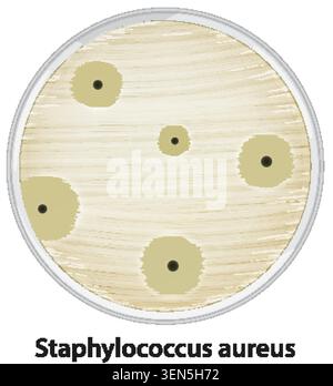 Top view vector illustration of Staphylococcus aureus colonies growing on agar within a petri dish Stock Vector