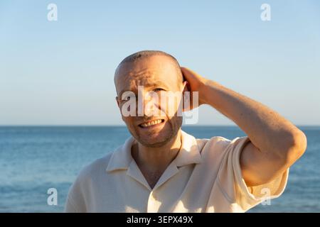 Confused Man Rubbing Head with Hair Transplant Standing by Sea Stock Photo