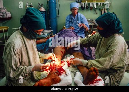 ICRC hospital, Kabul, Afghanistan, August 1992; Surgeons operate on a new land mine victim. After 14 years of war the county is a minefield, with over 56,000 amputees. Stock Photo