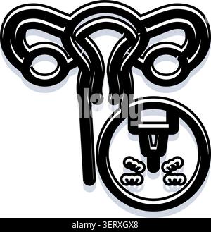Medical illustration representing female reproductive organs including ...