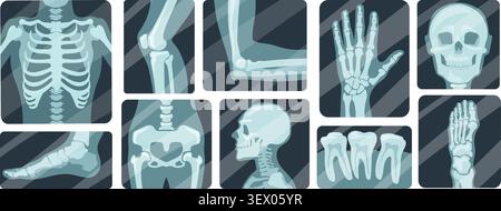 X ray radiography. Bone skeleton anatomy medical scan, arm leg foot hand knee elbow joint fracture hospital diagnosis treatment surgery human body health neat vector illustration original artwork Stock Vector