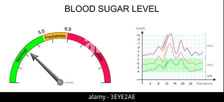 Blood sugar level. Comparison Normal, Prediabetes and Type 2 Diabetes glucose range. medical illustration. Vector infographic diagram Stock Vector