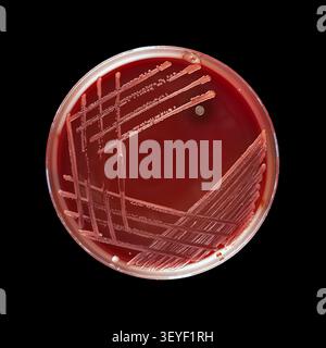 Accidental Contamination in Streaked Agar Stock Photo