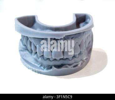 3D printed dental model created using photopolymer resin on 3D printer. Upper and lower jaws printed on 3D printer from liquid resin isolated on white background. SLA technology Stereolithography Stock Photo