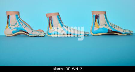 Comparison of three anatomical foot models showing different pathologies on doctor table in clinic. Visual guide for orthopedic treatment. Stock Photo