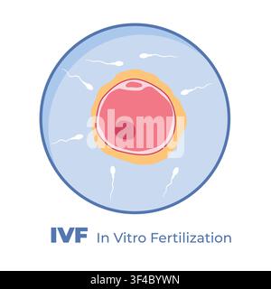 IVF In Vitro Fertilization process process, concept of assisted reproductive technology and fertility treatment - vector illustration Stock Vector