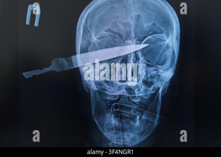A close-up medical X-ray radiograph of a human skull with a large knife blade impaled inside, showing a severe head trauma, brain injury, stab wound, Stock Photo