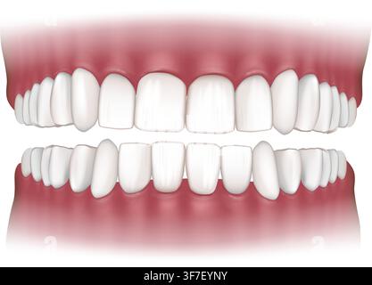 Detailed vector 3D medical illustration of normal human dentition showing healthy upper and lower teeth with regular dental alignment and natural Stock Vector