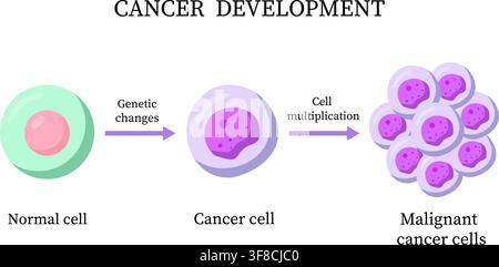 Cancer development stages from normal cell to malignant tumor illustration Stock Vector