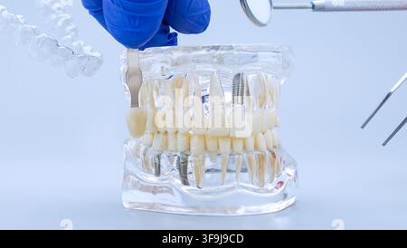 Advanced dentistry concept: Tooth color selection on a transparent jaw model with floating orthodontic and diagnostic instruments. Stock Photo
