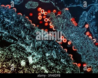 HIV virus  Transmission electron micrograph of HIV-1 particles (red/yellow) budding from a chronically infected H9 cell (blue/teal). The viral particles are captured in various stages of maturity. Arc/semi-circle shapes show immature particles still forming on the cell. Over time, these change morphology into mature forms, displaying a classic conical or spherical-shaped core.  Image captured at the NIAID Integrated Research Facility (IRF) in Fort Detrick, Maryland. An optimised and enhanced version of a scanning electron micrograph image. Credit: NIAID / NIH Stock Photo