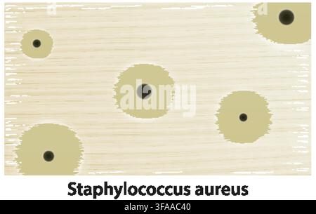 Scientific vector illustration of Staphylococcus aureus bacterial colonies growing on a textured agar surface Stock Vector