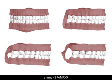 Polygonal human teeth set with four different types, each missing one tooth. Animated 3D render creates a dynamic motion effect. Stock Vector