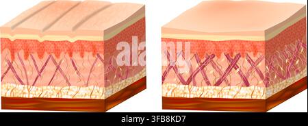 Medical illustration comparing young and aged human skin structure. Cross section shows collagen and elastin fibers, fibroblasts, dermis, epidermis Stock Vector