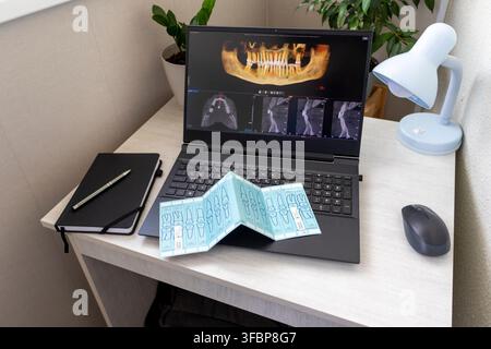 Laptop Displaying Dental 3D CBCT Tomography Software with Medical Packaging Strip on Keyboard Stock Photo