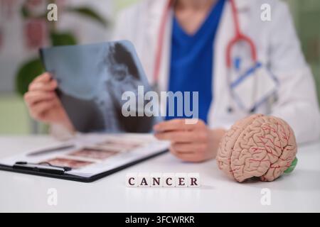Doctor oncologist looks at xray of patient with brain cancer closeup Stock Photo