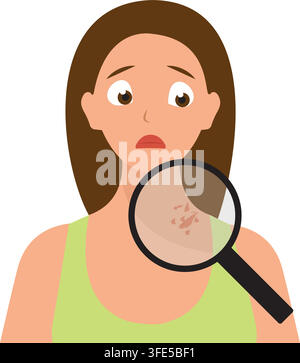 Worried Woman Checking Shingles Rash on Neck with Magnifying Glass Vector. Stock Vector
