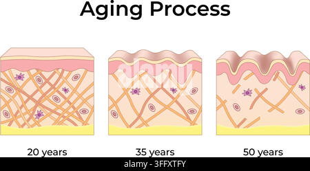 Aging Process of Skin Showing Structural Changes at 20 35 and 50 Years Stock Vector
