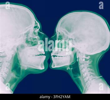 x-ray visualization illustrating a poignant conceptual image of human love and intimacy, with two skulls in profile gently touching noses, symbolizing Stock Photo