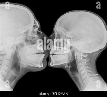 Two human skulls in profile are shown through x-ray imaging, depicting an intimate moment of two individuals kissing, highlighting themes of love and Stock Photo