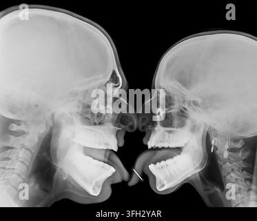 Two human skulls in profile are engaging in a passionate kiss, revealing the anatomical structures of their heads, mouths, and extended tongues Stock Photo