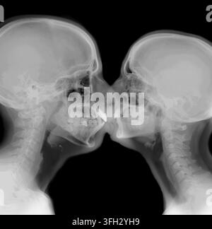 Two human skulls in profile are touching lips, creating an abstract representation of love, romance, and connection through the revealing science of a Stock Photo