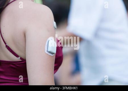 Person monitoring blood sugar levels with a wearable medical device for diabetes management Stock Photo