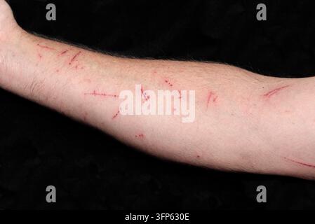 Scratches and sharpening marks on the forearm - close-up crack wound, cropped Stock Photo