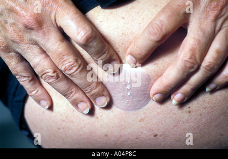 Menopausal woman putting on a HRT patch. Stock Photo