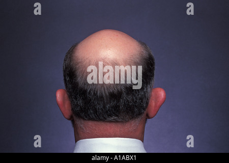 Back view of man with bald spot on head wearing white shirt Stock Photo
