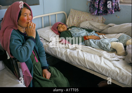 MINES IN AFGHANISTAN . MARIAM , MINE VICTIM, INDIRA GANDHI HOSPITAL KABUL 1996 Stock Photo