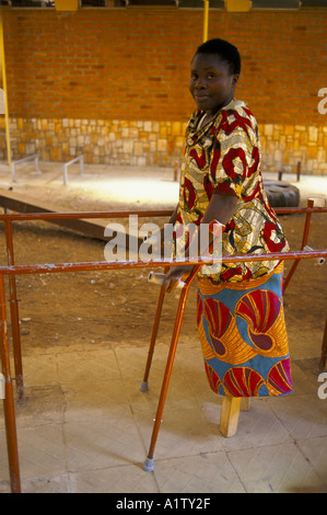 DOUBLE AMPUTEE IN KIGALI HOSPITAL RWANDA ,after she was attacked during the genocide. Stock Photo