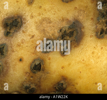 Powdery scab Spongospora subterranea lesions on a potato tuber Stock Photo