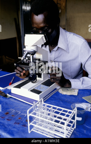 MAN LOOKING THROUGH MICROSCOPE IN YOYO DISPENSARY LAB TESTING FOR MALARIA IKAFE UGANDA 1996 Stock Photo
