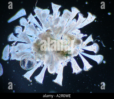 Stentor Cluster micrograph  photo microscopy of pond water Stock Photo