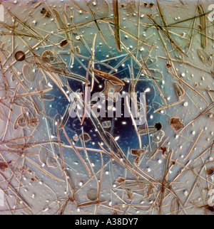 Diatoms strewn slide mixture Stock Photo