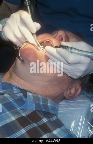 Dentist in blue shirt and white background examining a dental splint ...