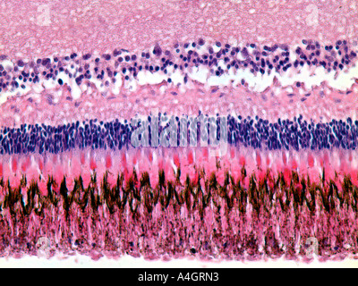 Fish retina (internal eye structure) in a stained histological section ...