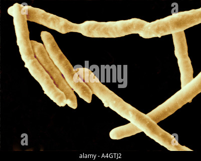 This is a scanning electron micrograph of Yersinia enterocolitica. Y enterocolitica belongs to a family of rod-shaped bacteria Stock Photo