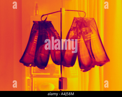 rack of IV intravenous bags hanging in hospital intensive care ward for ...