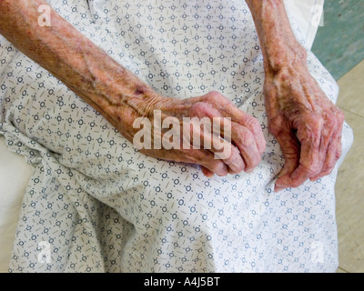 exhausted 80 year old woman resting after a whirlpool wound treatment  session in a hospital rehabilitation center Stock Photo