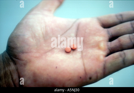 ADDICT SMOKES YABAA THE CRAZY DRUG THAILAND Stock Photo