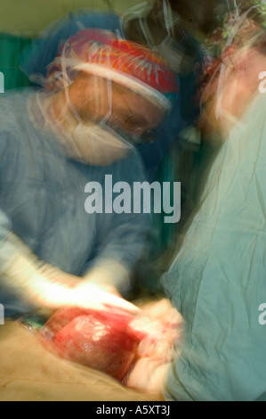 Action shot of volunteer surgeons in Nigeria wearing face mask cap gloves and gown to prevent the spread of infections during su Stock Photo
