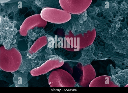 scanning electron micrograph showing red blood cells in a fibrin matrix Stock Photo