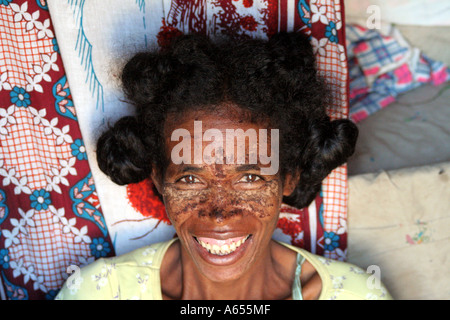 Woman wearing a mud mask in Ifaty, north of Toliara, ( Tulear ), Madagascar Stock Photo