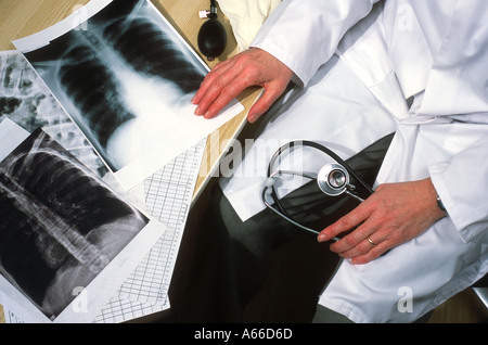 Doctor in surgery with chest x-rays on the desk Hands only Stock Photo