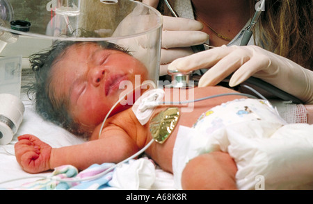 Premature infant Stock Photo